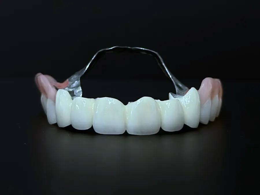 Proteză dentară cu bară metalică, pe fundal negru