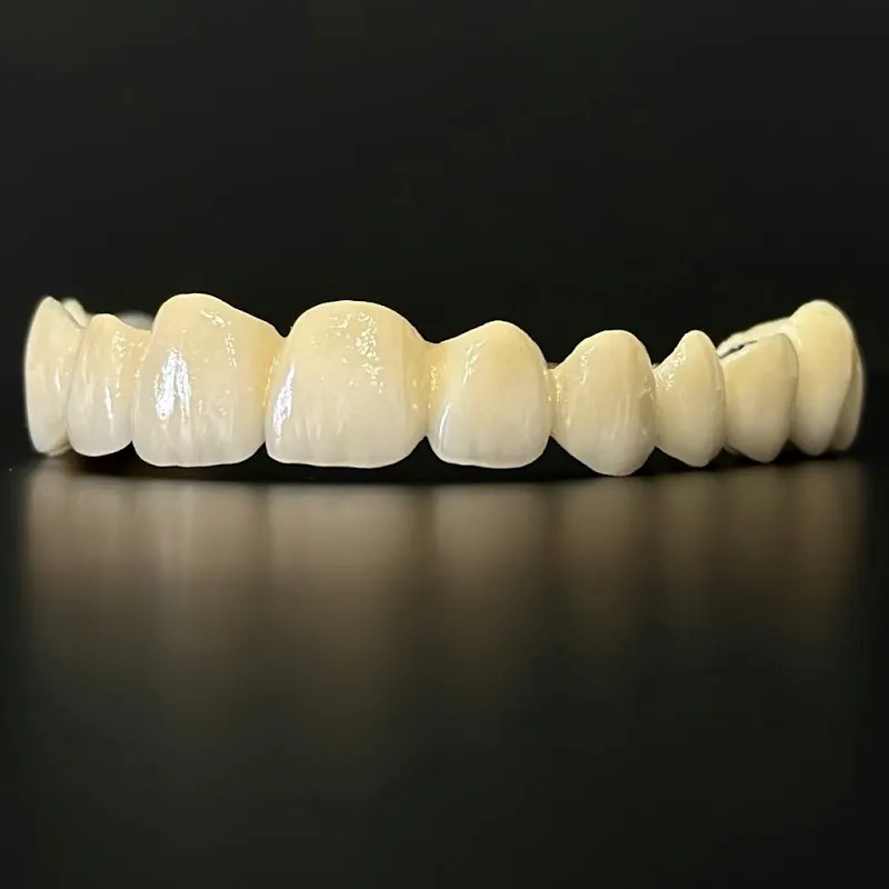 Punte ceramică, a doua vedere din lateral